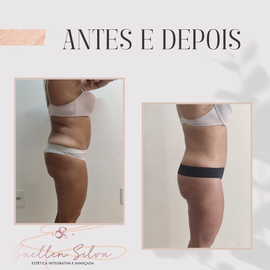 WhatsApp Image 2025-07-14 at 12.39.23