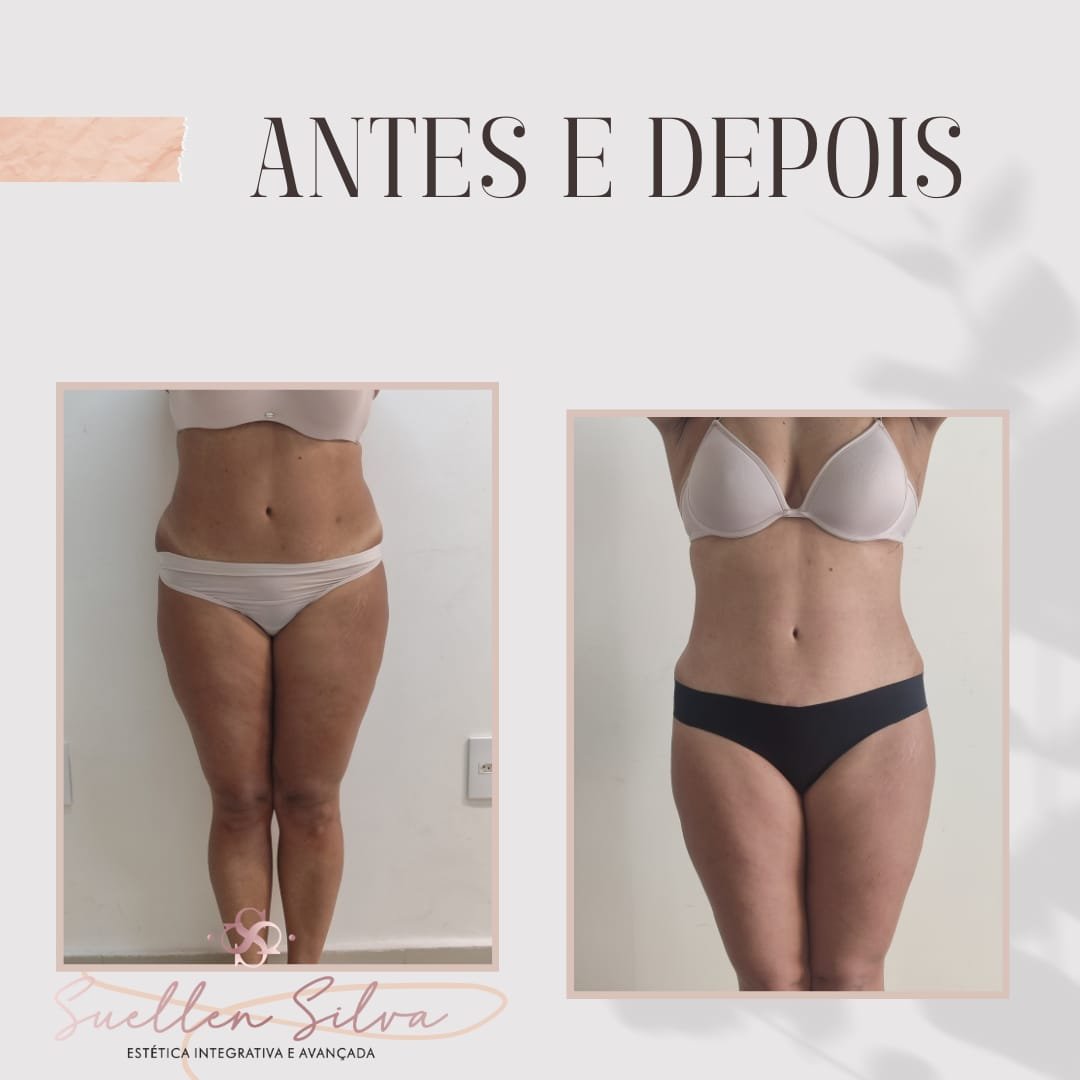 WhatsApp Image 2025-07-14 at 12.39.44